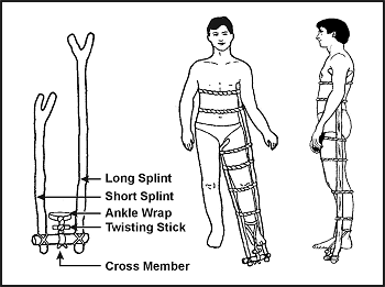Figure 4-6. Improvised Traction Splint